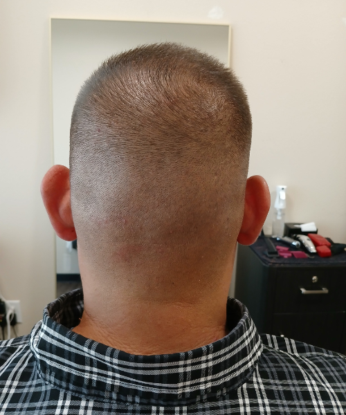 A man with a checkered shirt has a shaved back